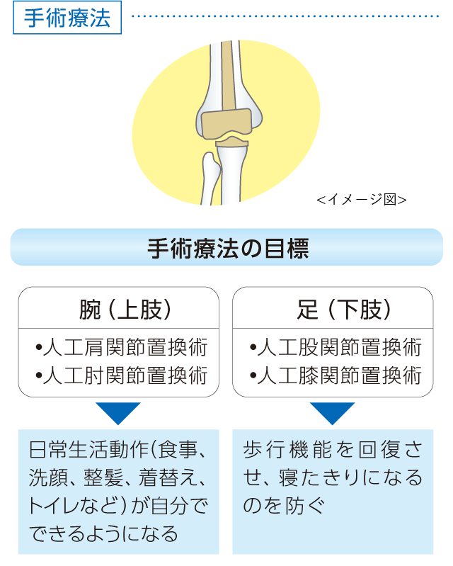 関節リウマチの治療法
